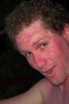 Joshy sunburnt